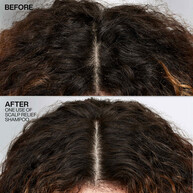 DANDRUFF CONTROL SHAMPOO