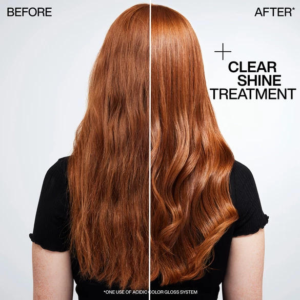 Before and After