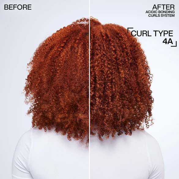 Before and After