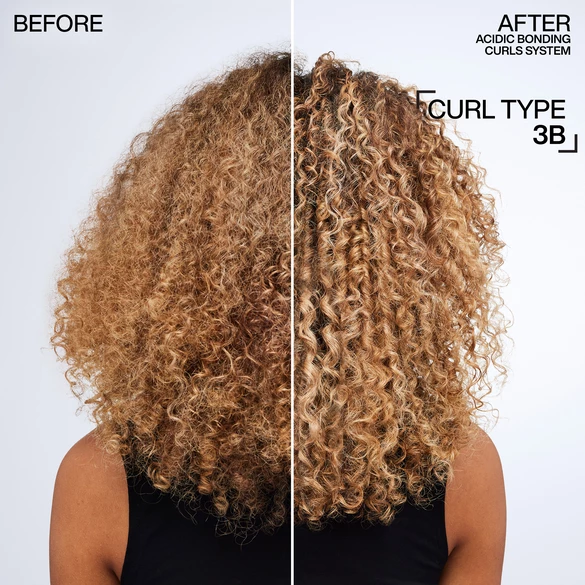 Before and After