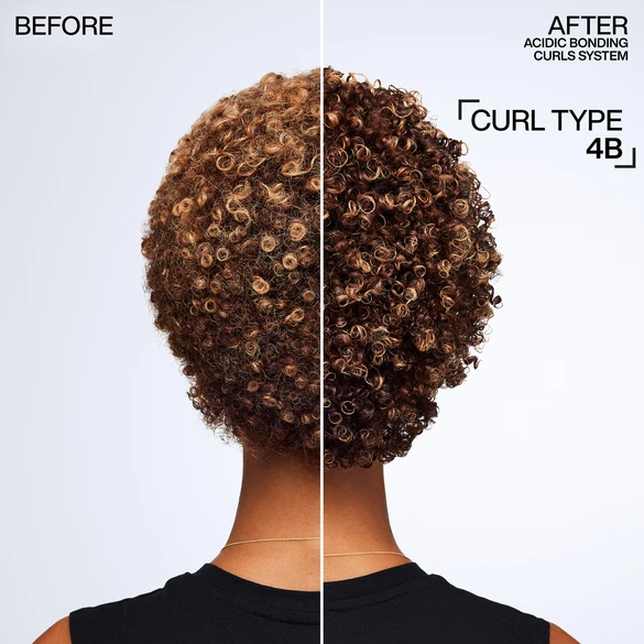 Before and After