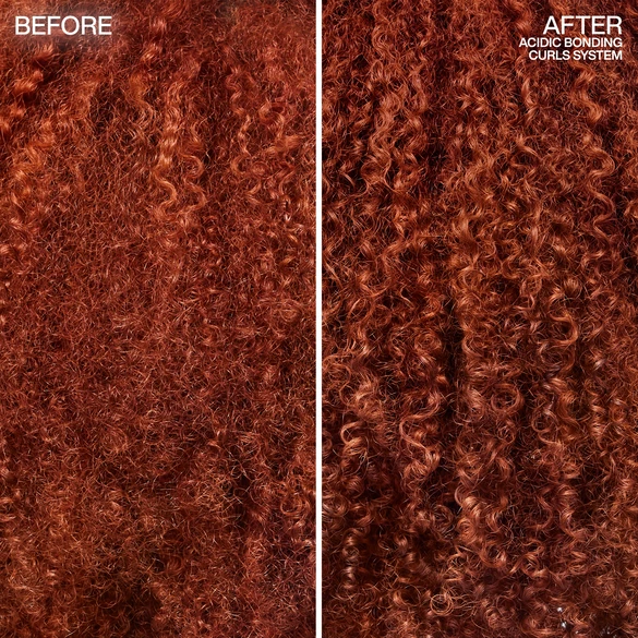 Before and After
