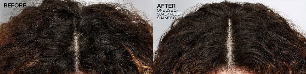 Redken Hair Care Scalp Relief Dandruff Control Shampoo Before & After