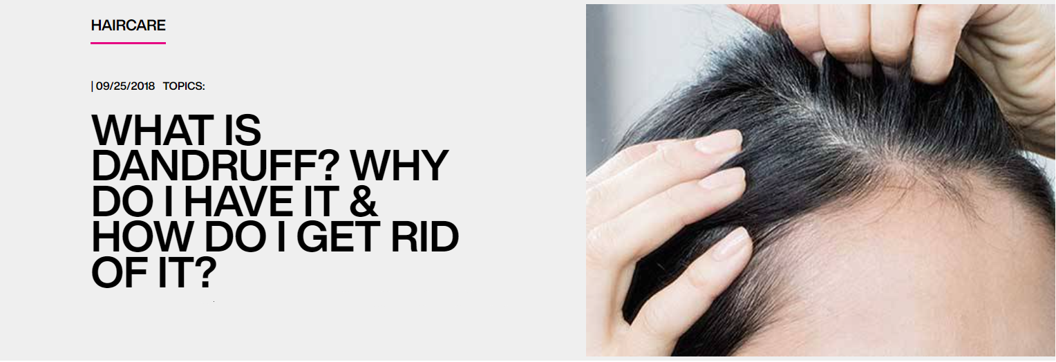 How to get dandruff out of hair deals